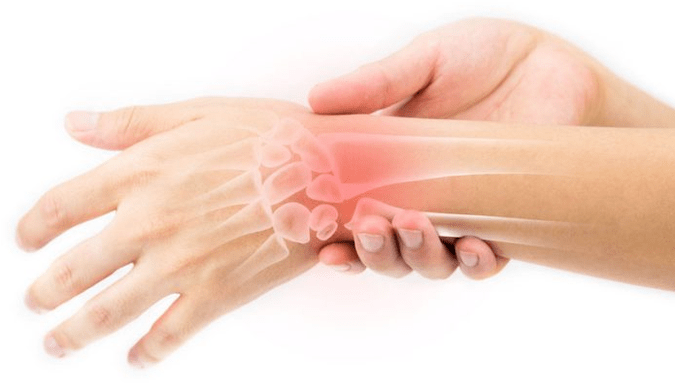 关节，软骨和韧带疾病-使用本霜的适应症