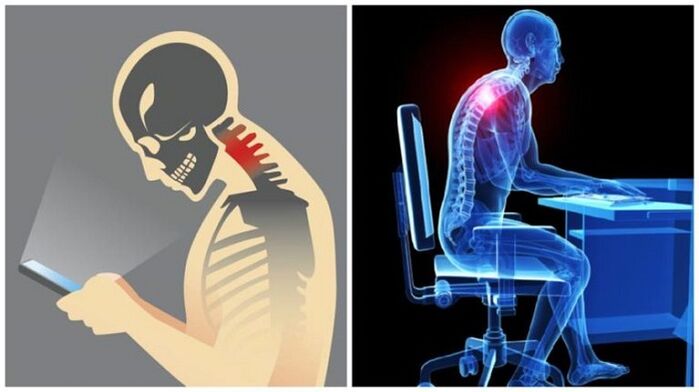 久坐和弯腰是骨软骨病发展的原因