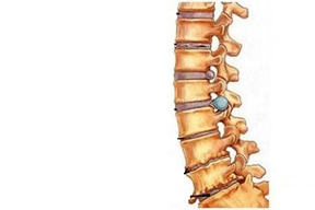 颈骨软骨病不同发展时期脊柱的变化